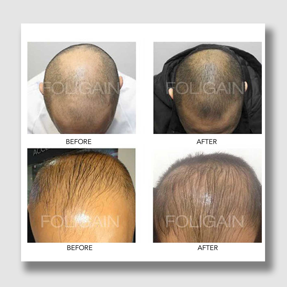 Delivery FOLIGAIN EUROPE delivery-foligain-europe