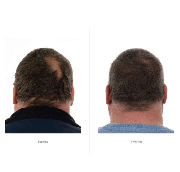 FOLIGAIN Triple Action Hair Care System For Men 3 Piece Trial Set