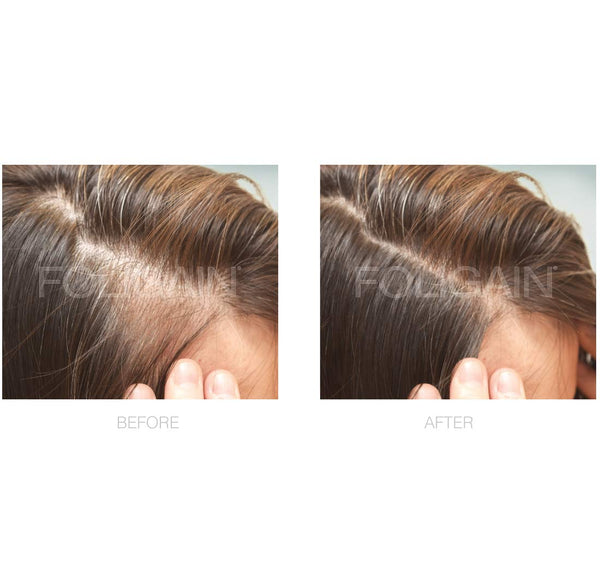 FOLIGAIN Minoxidil 2% Hair Regrowth Treatment For Women - FOLIGAIN EU